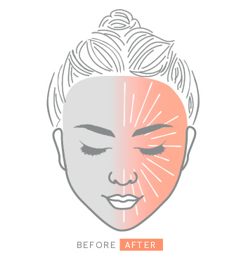 Illustration of face representing benefits of Mary Kay Clinical Solutions Ferulic + Niacinamide Brightener