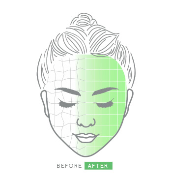 Illustration of face representing benefits of Mary Kay Clinical Solutions PHA + AHA Resurfacer